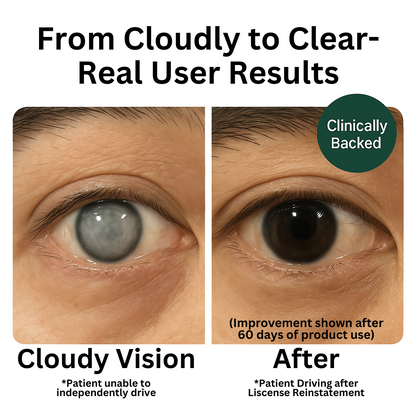 Zoone™ Lutein Eye Vitamins (UNUSED)