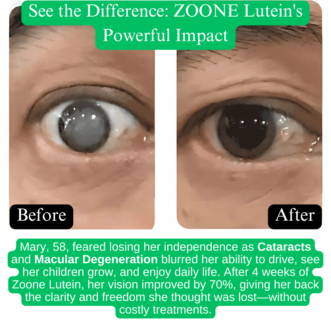 Zoone™ Lutein & Zeaxanthin Eye Vitamins